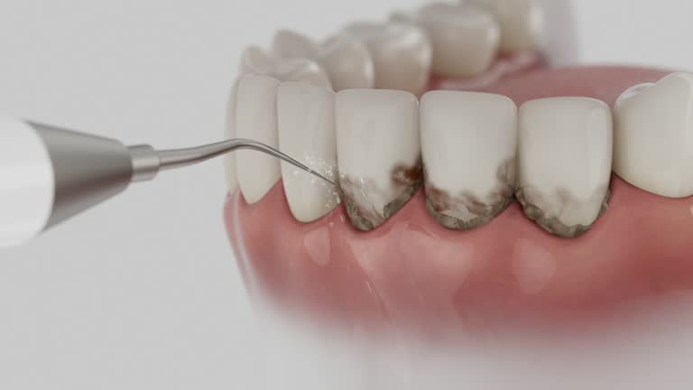 Trusted Invisalign Clear Aligners service in Queensland, MD - Dentist Open Now